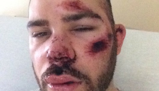 Allied Universal, Joseph Fusco, public safety Director, Uber, Fight